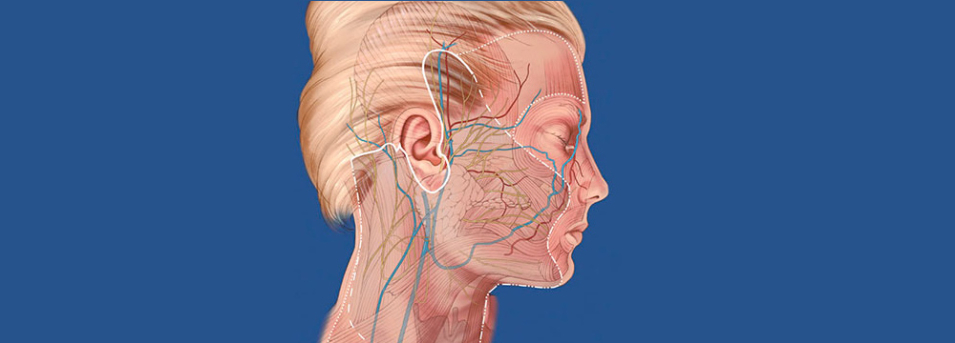 Фэйслифтинг