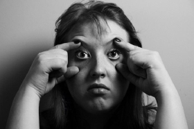 Блефаропластика