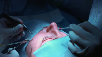 Блефаропластика: ход операции