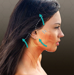 Подтяжка лица