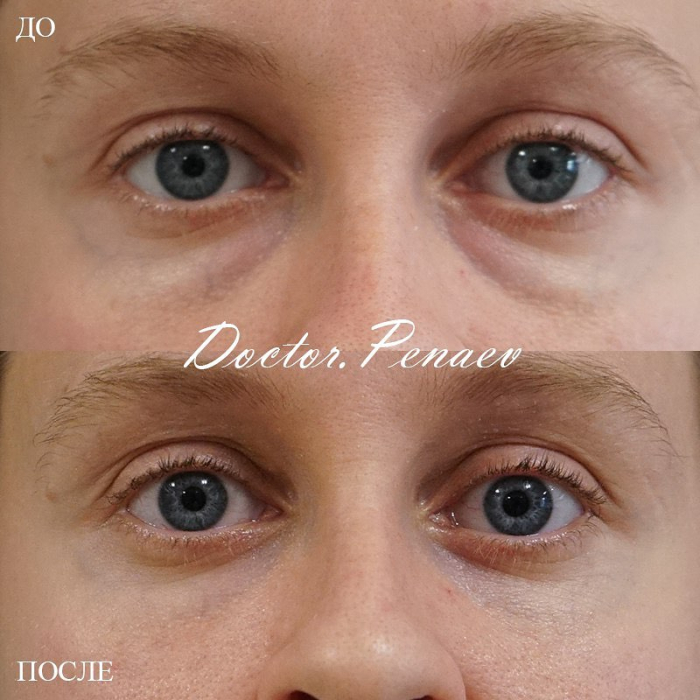 Пациентка пластического хирурга Арслана Пенаева