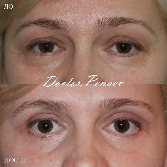 Пациентка пластического хирурга Арслана Пенаева