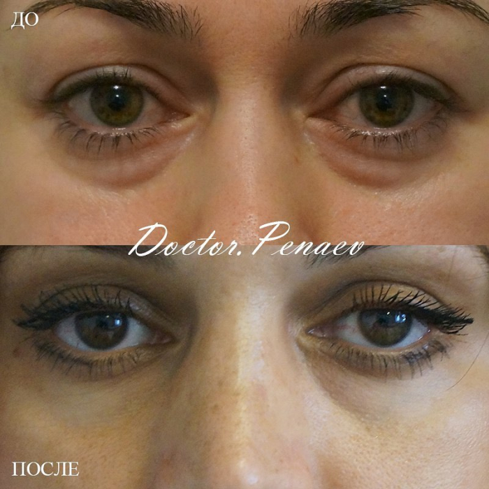 Пациентка пластического хирурга Арслана Пенаева