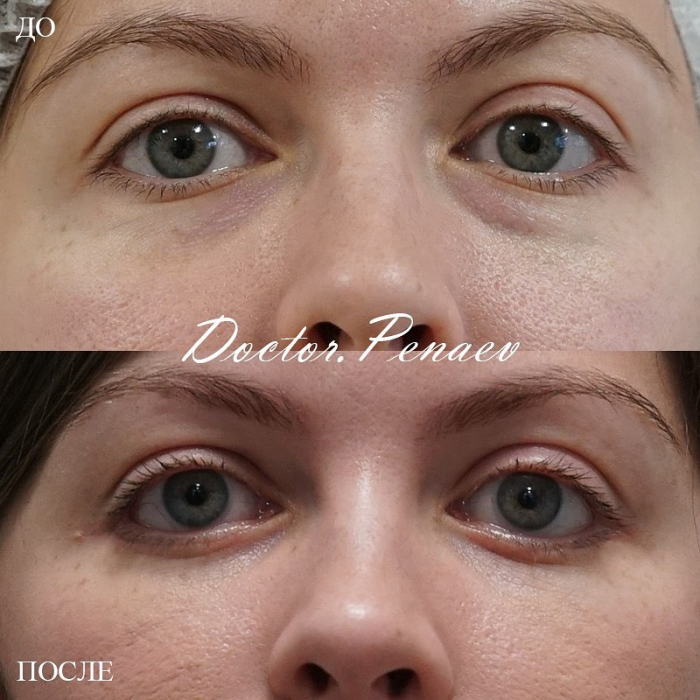Пациентка пластического хирурга Арслана Пенаева