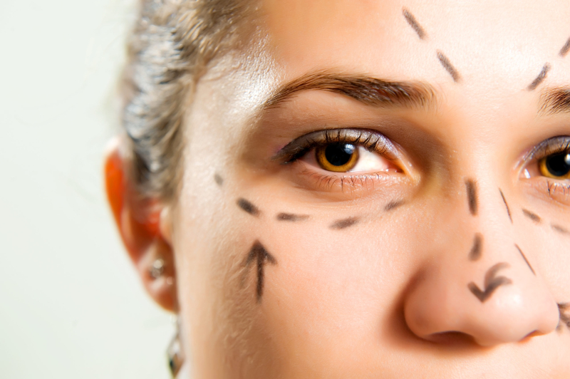 Шрамы на лице после пластической операции	