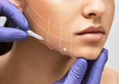 Как нитевой лифтинг может улучшить черты лица
